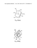 METHODS AND SYSTEMS FOR PERFORMING A MEDICAL PROCEDURE diagram and image