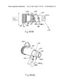 METHODS AND SYSTEMS FOR PERFORMING A MEDICAL PROCEDURE diagram and image