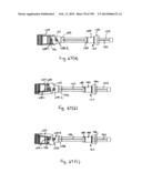 METHODS AND SYSTEMS FOR PERFORMING A MEDICAL PROCEDURE diagram and image