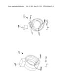 METHODS AND SYSTEMS FOR PERFORMING A MEDICAL PROCEDURE diagram and image