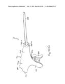 METHODS AND SYSTEMS FOR PERFORMING A MEDICAL PROCEDURE diagram and image