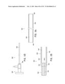 METHODS AND SYSTEMS FOR PERFORMING A MEDICAL PROCEDURE diagram and image