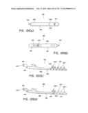 METHODS AND SYSTEMS FOR PERFORMING A MEDICAL PROCEDURE diagram and image