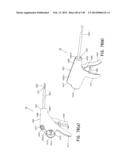 METHODS AND SYSTEMS FOR PERFORMING A MEDICAL PROCEDURE diagram and image