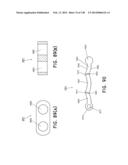 METHODS AND SYSTEMS FOR PERFORMING A MEDICAL PROCEDURE diagram and image