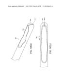 METHODS AND SYSTEMS FOR PERFORMING A MEDICAL PROCEDURE diagram and image