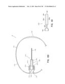 METHODS AND SYSTEMS FOR PERFORMING A MEDICAL PROCEDURE diagram and image