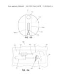 METHODS AND SYSTEMS FOR PERFORMING A MEDICAL PROCEDURE diagram and image