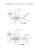 METHODS AND SYSTEMS FOR PERFORMING A MEDICAL PROCEDURE diagram and image