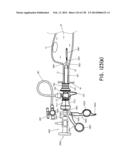 METHODS AND SYSTEMS FOR PERFORMING A MEDICAL PROCEDURE diagram and image