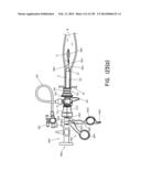 METHODS AND SYSTEMS FOR PERFORMING A MEDICAL PROCEDURE diagram and image