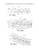 METHODS AND SYSTEMS FOR PERFORMING A MEDICAL PROCEDURE diagram and image