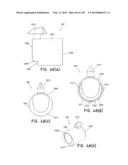 METHODS AND SYSTEMS FOR PERFORMING A MEDICAL PROCEDURE diagram and image