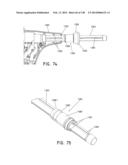 METHODS AND SYSTEMS FOR PERFORMING A MEDICAL PROCEDURE diagram and image