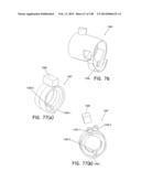 METHODS AND SYSTEMS FOR PERFORMING A MEDICAL PROCEDURE diagram and image