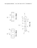 METHODS AND SYSTEMS FOR PERFORMING A MEDICAL PROCEDURE diagram and image