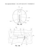 METHODS AND SYSTEMS FOR PERFORMING A MEDICAL PROCEDURE diagram and image