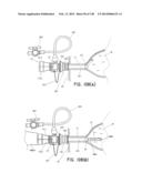 METHODS AND SYSTEMS FOR PERFORMING A MEDICAL PROCEDURE diagram and image