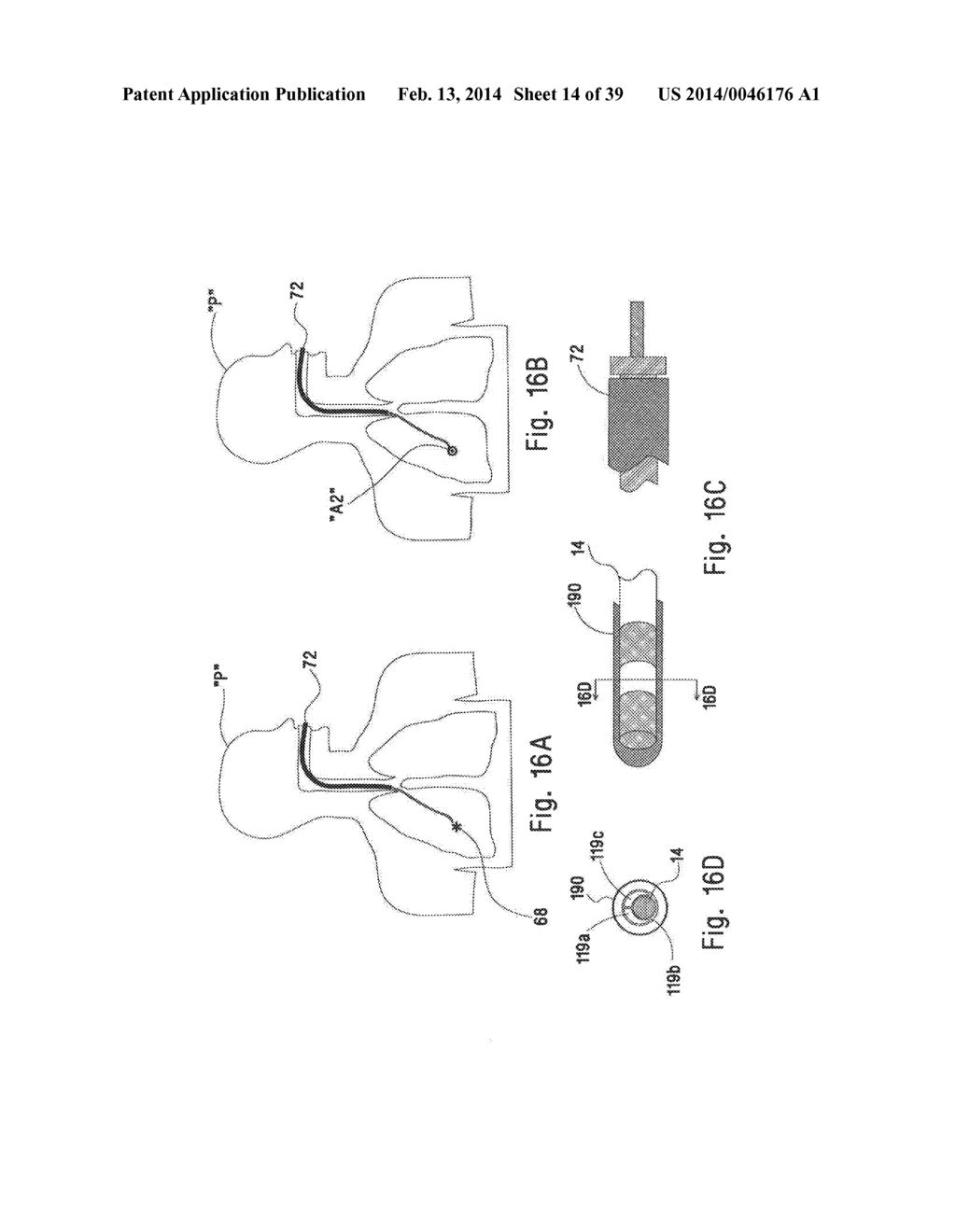 MICROWAVE ABLATION CATHETER AND METHOD OF UTILIZING THE SAME - diagram, schematic, and image 15