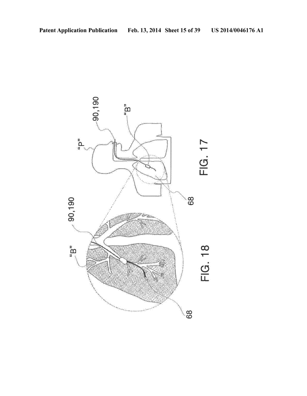 MICROWAVE ABLATION CATHETER AND METHOD OF UTILIZING THE SAME - diagram, schematic, and image 16