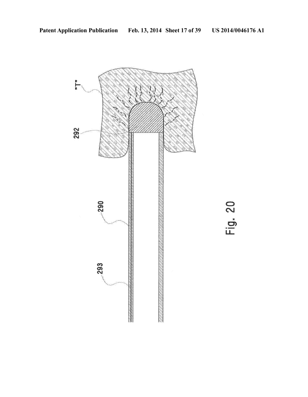 MICROWAVE ABLATION CATHETER AND METHOD OF UTILIZING THE SAME - diagram, schematic, and image 18