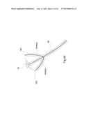 MICROWAVE ABLATION CATHETER AND METHOD OF UTILIZING THE SAME diagram and image