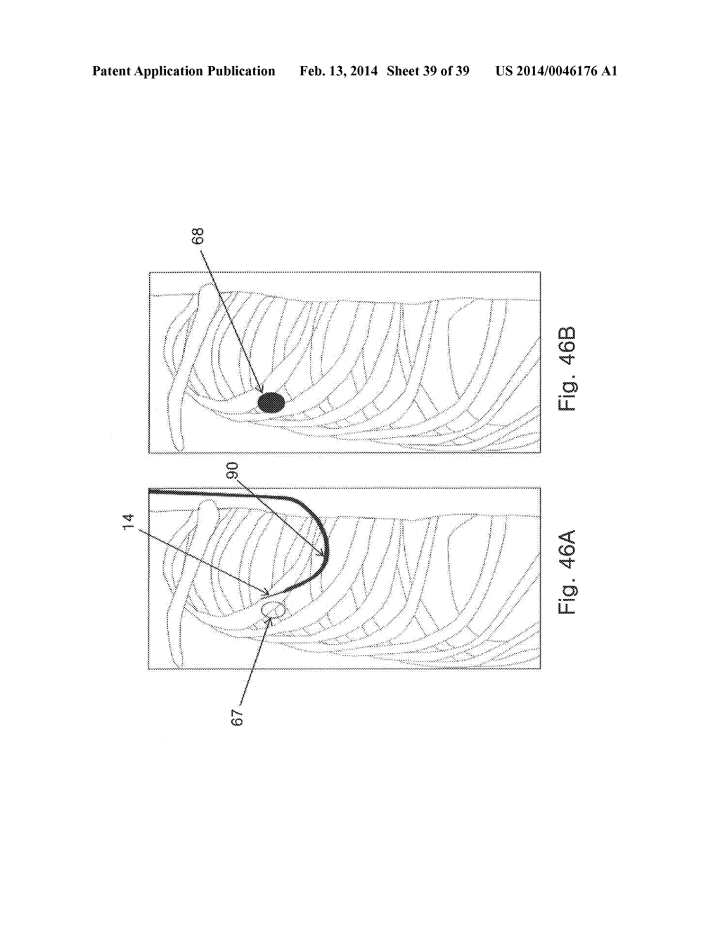 MICROWAVE ABLATION CATHETER AND METHOD OF UTILIZING THE SAME - diagram, schematic, and image 40