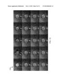 ACOUSTICALLY RESPONSIVE PARTICLES WITH DECREASED CAVITATION THRESHOLD diagram and image