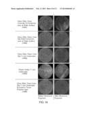 ACOUSTICALLY RESPONSIVE PARTICLES WITH DECREASED CAVITATION THRESHOLD diagram and image