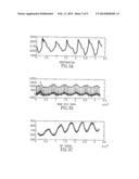 APPARATUS AND METHOD FOR ESTIMATING STROKE VOLUME OF THE HEART USING     BIO-IMPEDANCE TECHNIQUES diagram and image