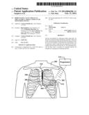 ROBUST RATE CALCULATION IN AN IMPLANTABLE CARDIAC STIMULUS OR MONITORING     DEVICE diagram and image