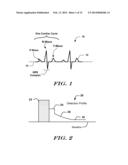 ROBUST RATE CALCULATION IN AN IMPLANTABLE CARDIAC STIMULUS OR MONITORING     DEVICE diagram and image