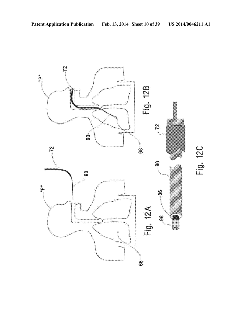 MICROWAVE ABLATION CATHETER AND METHOD OF UTILIZING THE SAME - diagram, schematic, and image 11