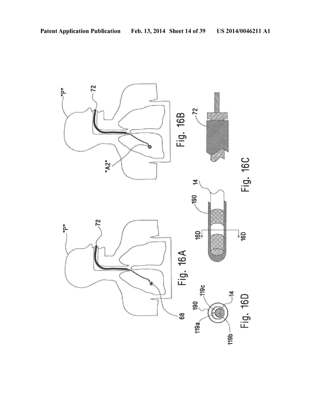 MICROWAVE ABLATION CATHETER AND METHOD OF UTILIZING THE SAME - diagram, schematic, and image 15