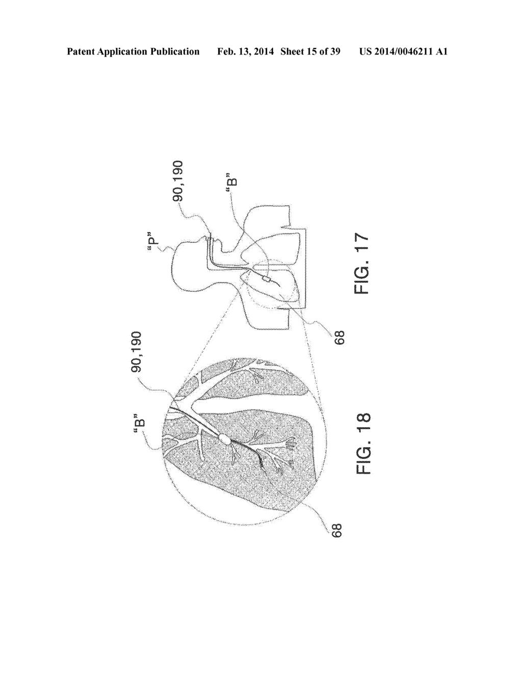 MICROWAVE ABLATION CATHETER AND METHOD OF UTILIZING THE SAME - diagram, schematic, and image 16