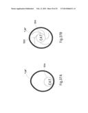 MICROWAVE ABLATION CATHETER AND METHOD OF UTILIZING THE SAME diagram and image