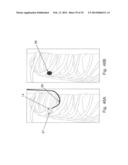 MICROWAVE ABLATION CATHETER AND METHOD OF UTILIZING THE SAME diagram and image