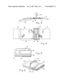 CHEST CONTAINMENT SYSTEM AND METHOD diagram and image