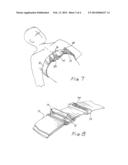 CHEST CONTAINMENT SYSTEM AND METHOD diagram and image