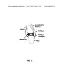 Dynamic Load Bearing Shock Absorbing Exoskeletal Knee Brace diagram and image