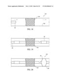 APPARATUS AND METHODS FOR CLOT DISRUPTION AND EVACUATION diagram and image