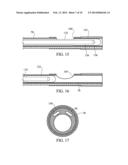 APPARATUS AND METHODS FOR CLOT DISRUPTION AND EVACUATION diagram and image