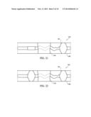 APPARATUS AND METHODS FOR CLOT DISRUPTION AND EVACUATION diagram and image