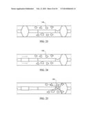 APPARATUS AND METHODS FOR CLOT DISRUPTION AND EVACUATION diagram and image