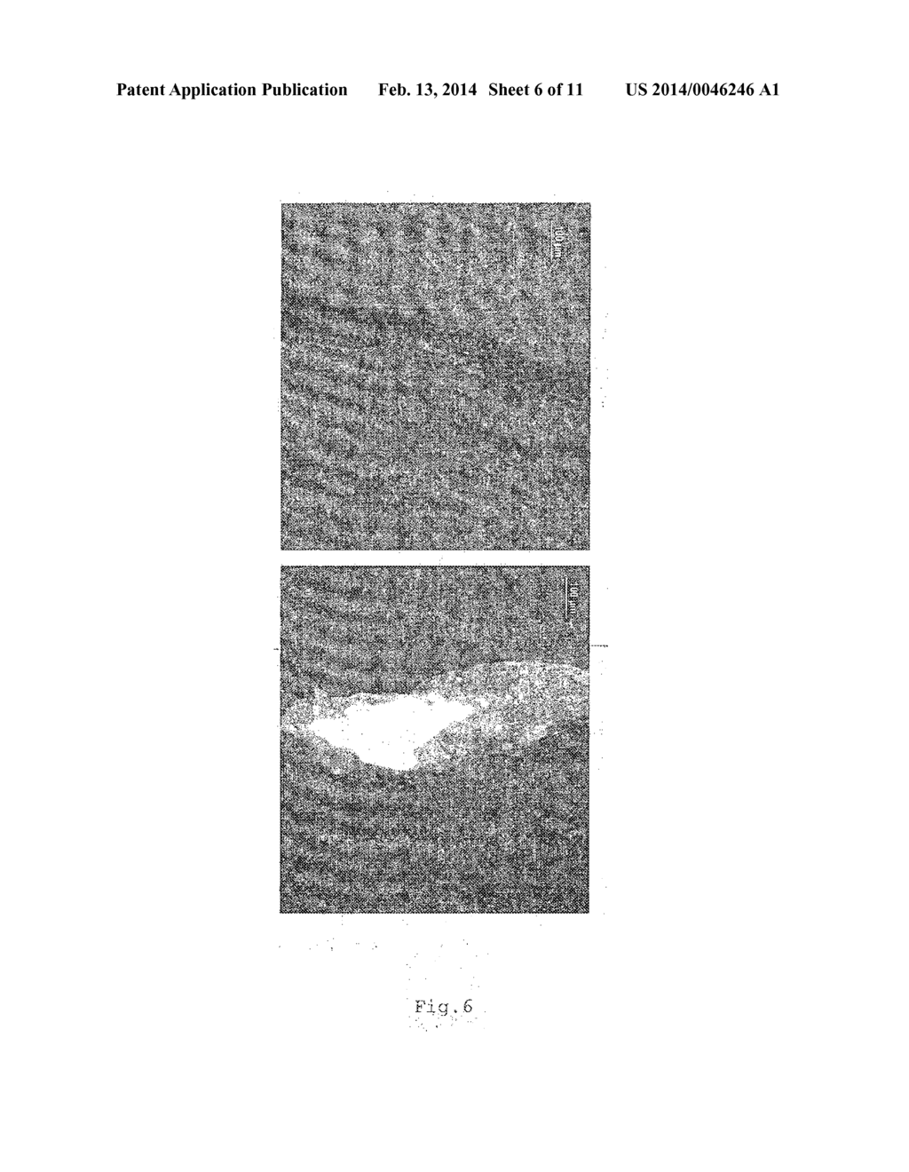 DEVICE FOR EFFICIENT DELIVERY OF COMPOUNDS TO OR THROUGH THE SKIN OR     BIOLOGICAL BARRIERS, USING LIGHT-ABSORBING THIN FILMS - diagram, schematic, and image 07