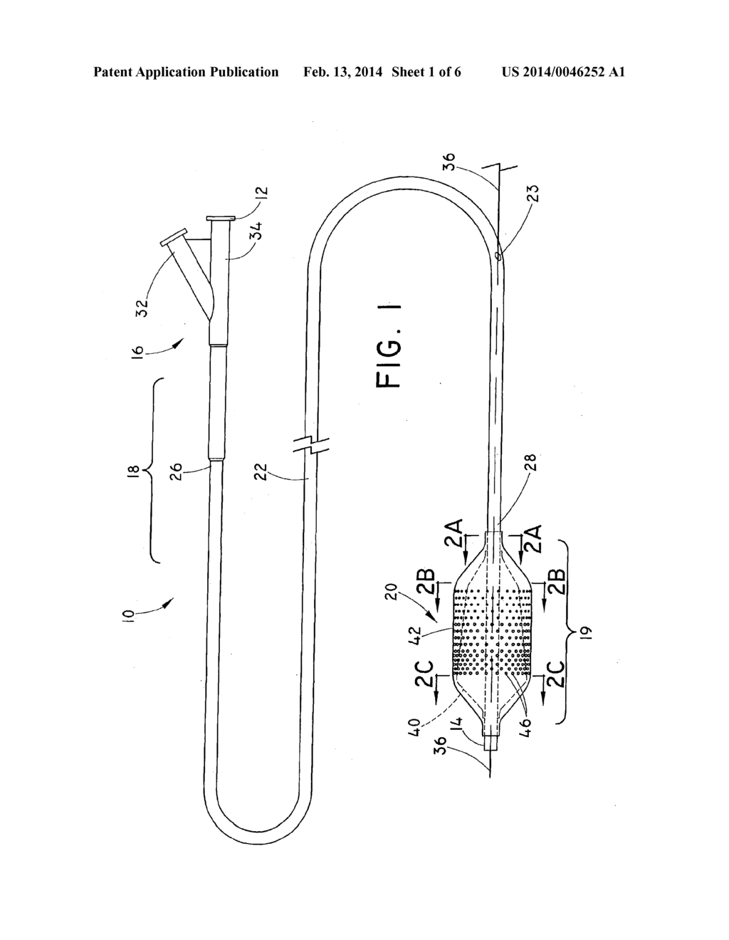 WEEPING BALLOON CATHETER - diagram, schematic, and image 02