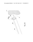 MICROWAVE ABLATION CATHETER AND METHOD OF UTILIZING THE SAME diagram and image