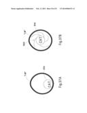 MICROWAVE ABLATION CATHETER AND METHOD OF UTILIZING THE SAME diagram and image