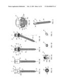 Staged Locking of Surgical Screw Assembly diagram and image