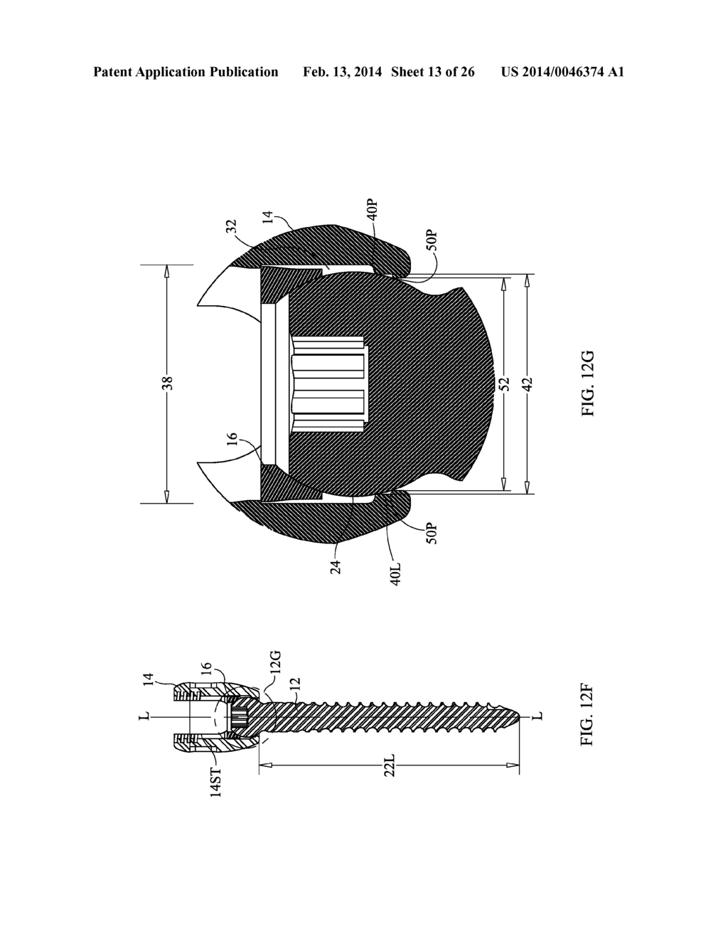 Staged Locking of Surgical Screw Assembly - diagram, schematic, and image 14